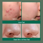 30-days-miracle-some-by-mi5