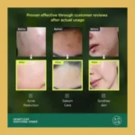 Screenshot_9-12-2025_1883_anua.com