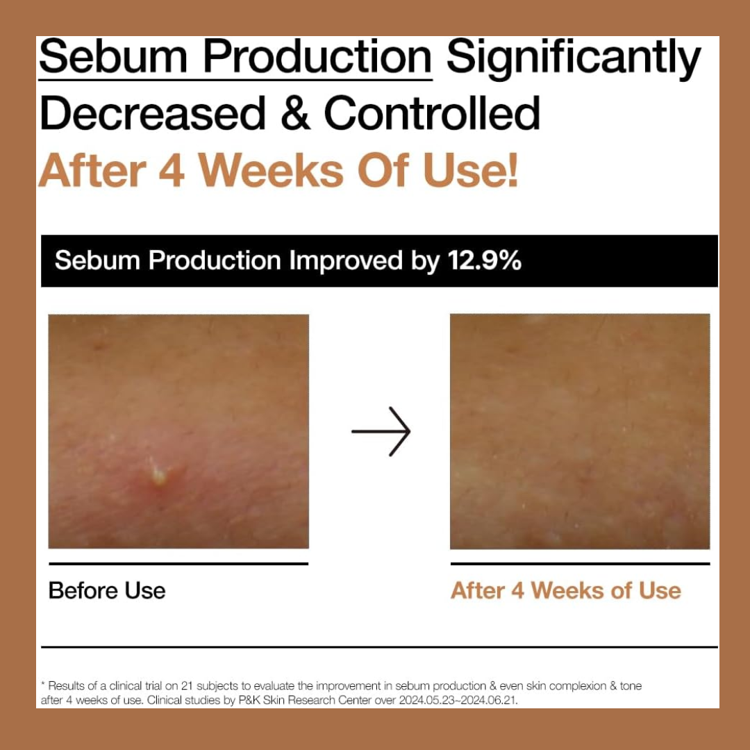 Anua Rice 70 Glow Milky Toner - 250ml (9)