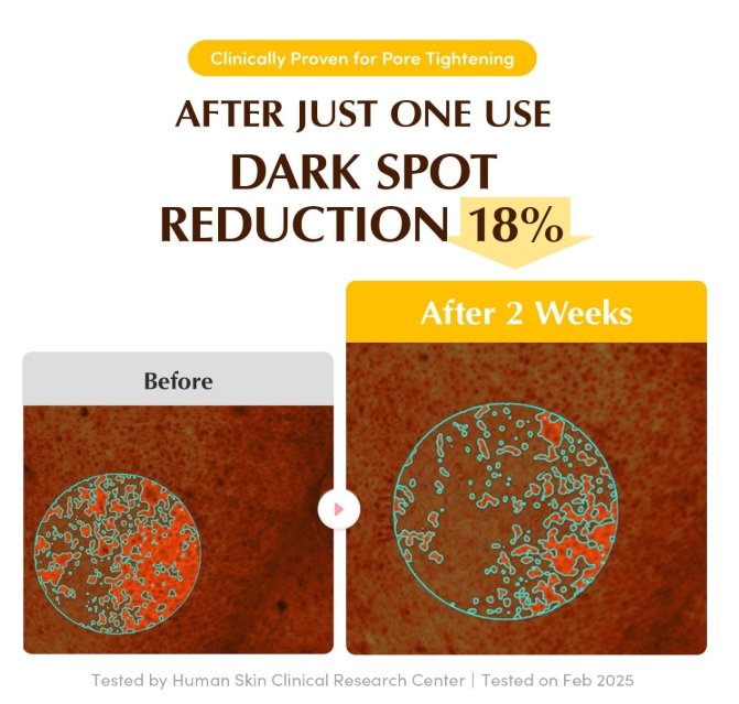 Screenshot_10-11-2025_12305_www.amazon.com